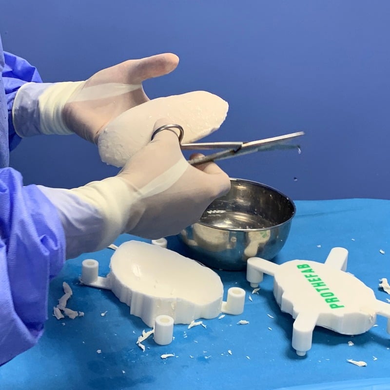 Fitting of the PMMA implant